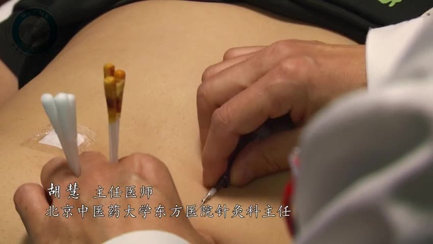 胡慧：套针减肥