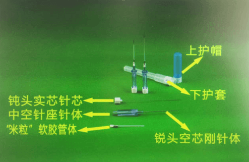 多功能套针疗法的概念解析