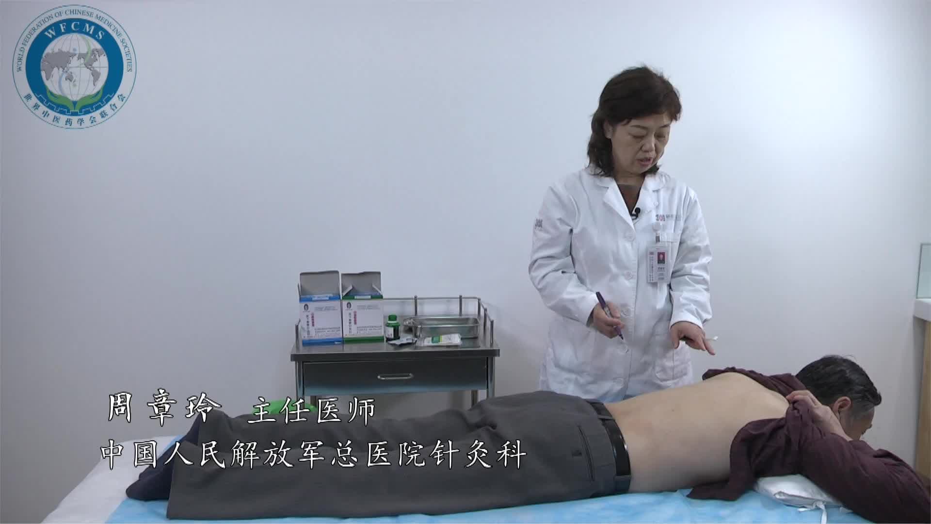 套针治疗腰椎间盘突出症（一）— 丁全茂教授（世中联套针专委会高峰论坛）