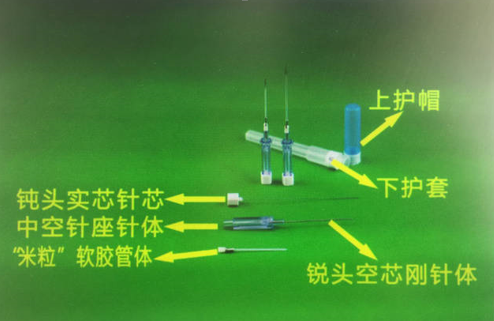 多功能套针疗法的概念解析